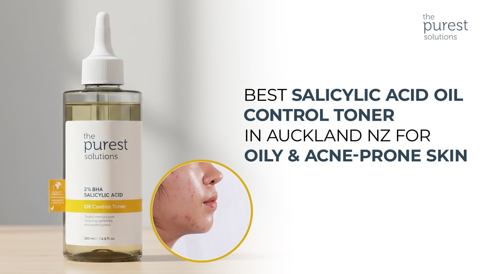 Best Salicylic Acid Oil Control Toner in Auckland NZ for Oily & Acne-Prone Skin